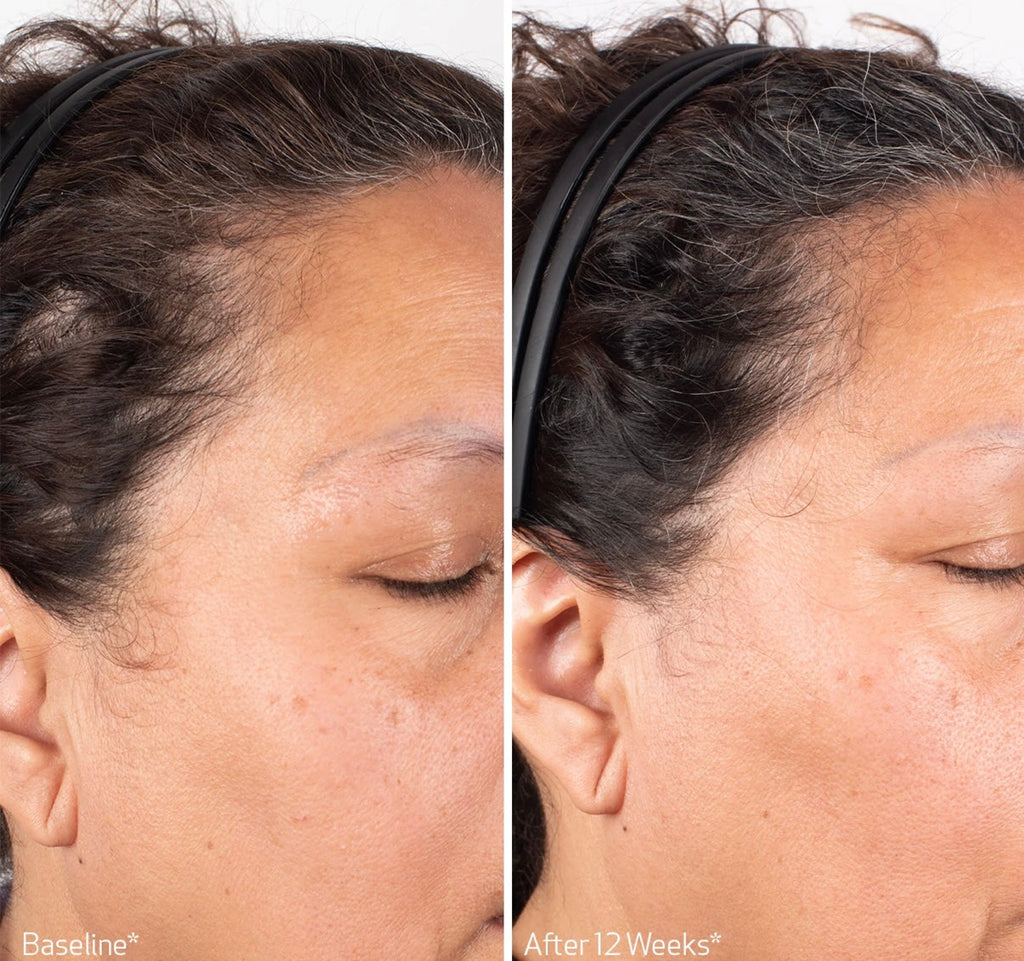 OBAGI Nu-Cil Biostim™ Scalp Serum
