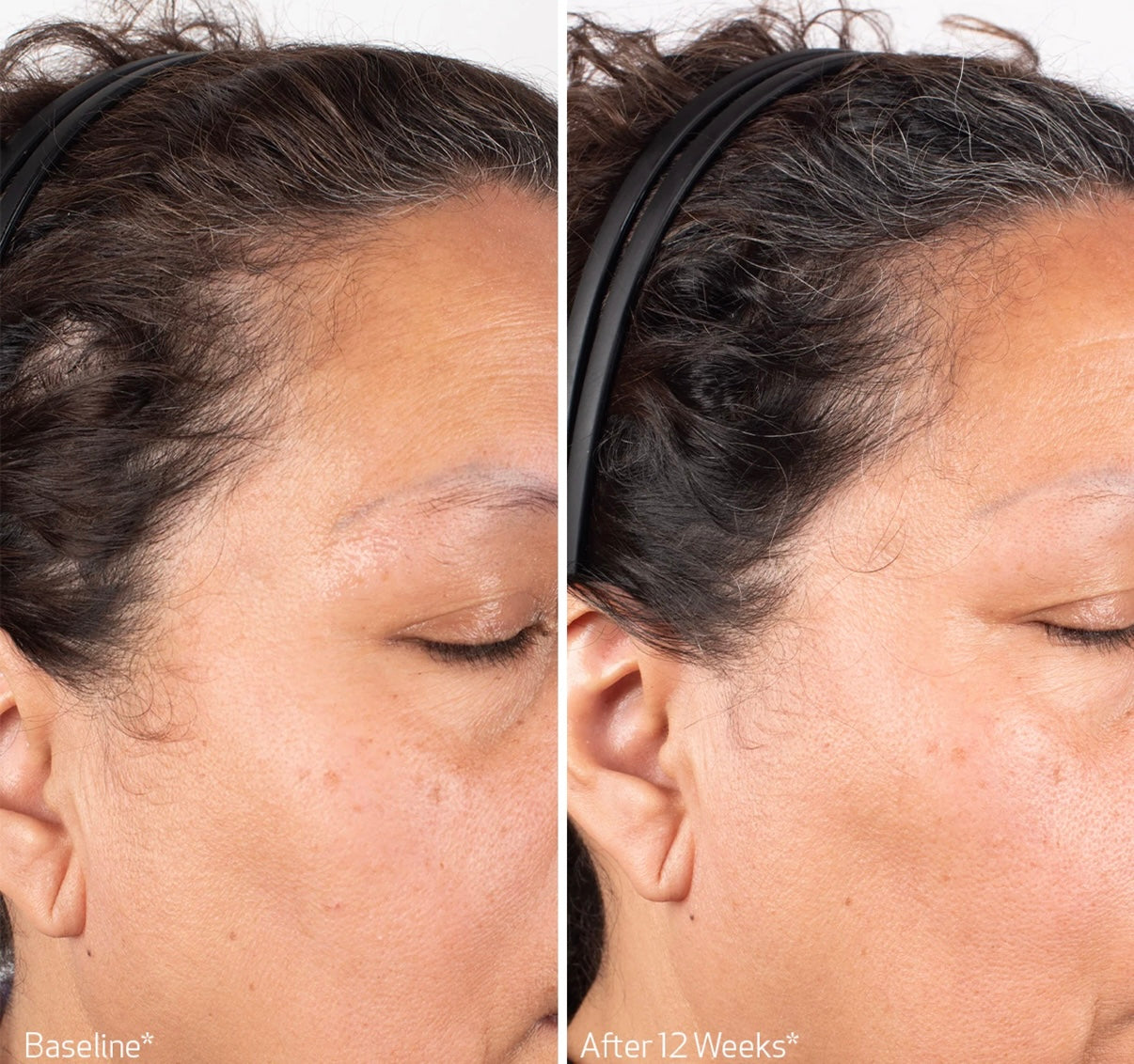 OBAGI Nu-Cil Biostim™ Scalp Serum