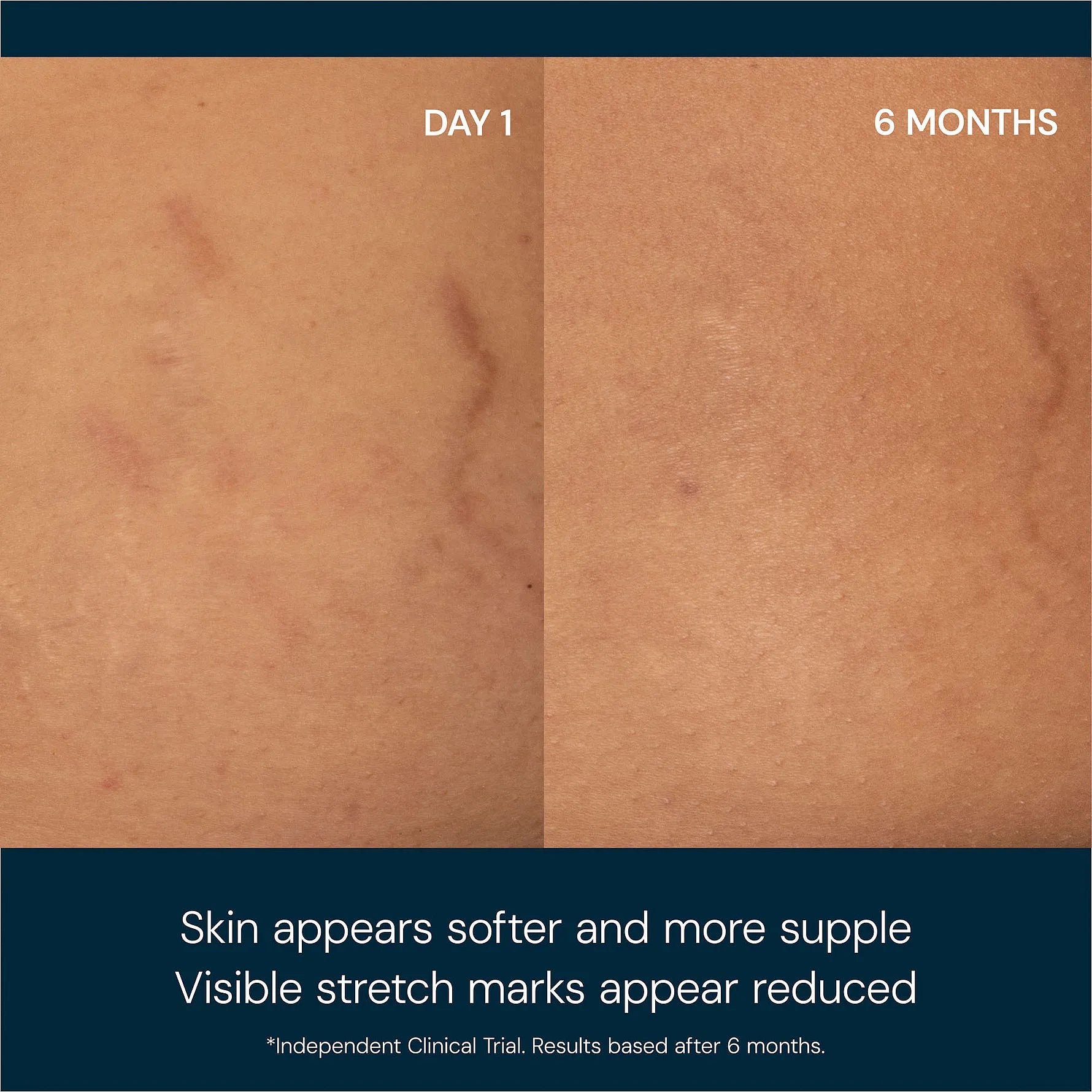 Elemis Japanese Camellia Body Oil Blend 100 ml