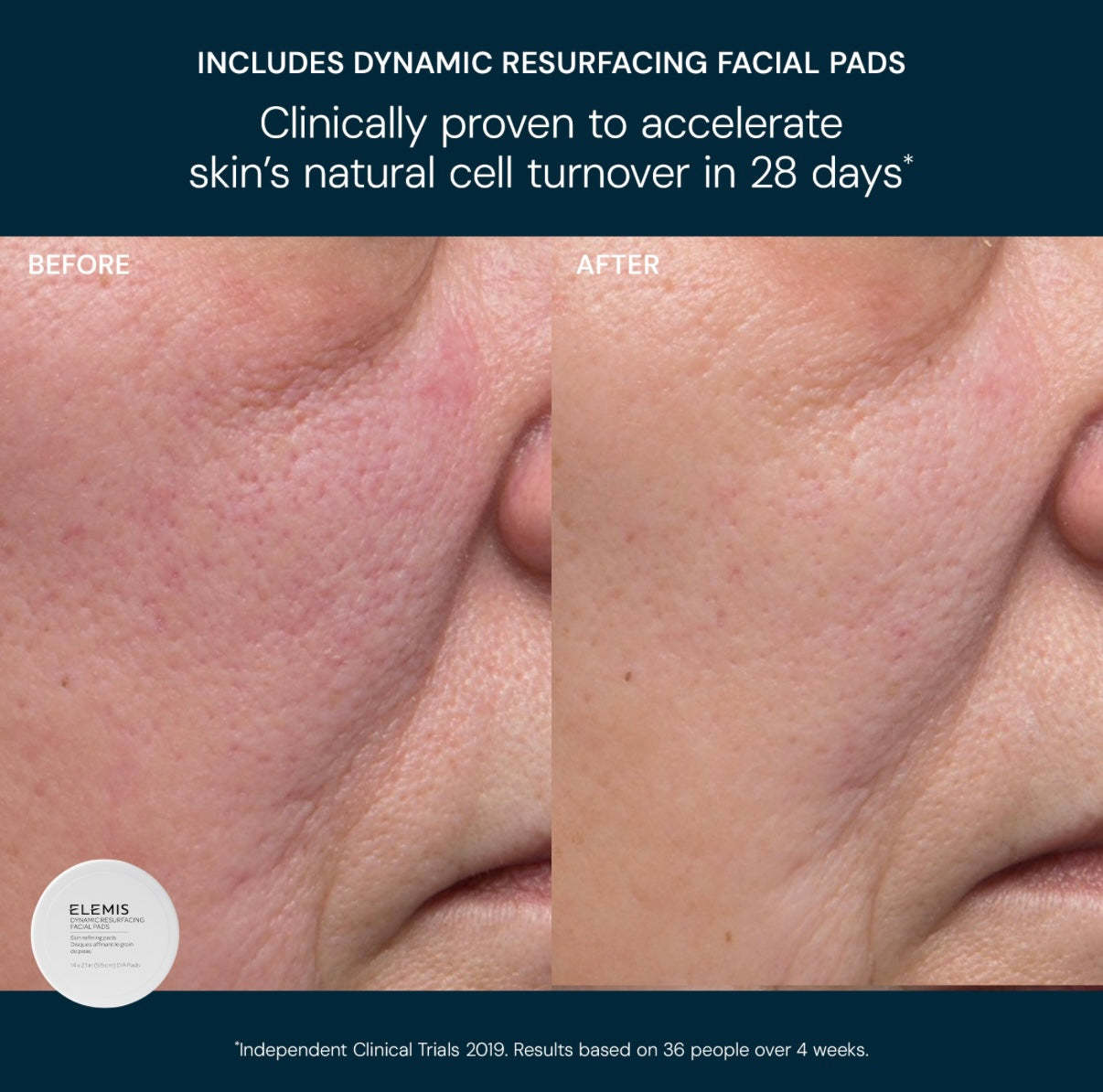 ELEMIS Glow Bright Resurfacing Trio VÄRDE 1749:-