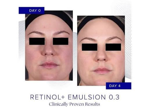 IS Clinical Retinol+ Emulsion 0.3
